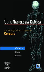 Serie Radiología Clínica: Los 100 diagnósticos principales en cerebro de Editorial Elsevier S.A
